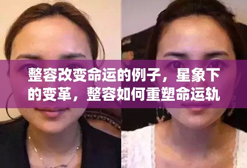 星象下的整容变革,重塑命运轨迹的真实案例