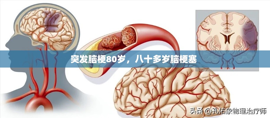 突发脑梗80岁,八十多岁脑梗塞